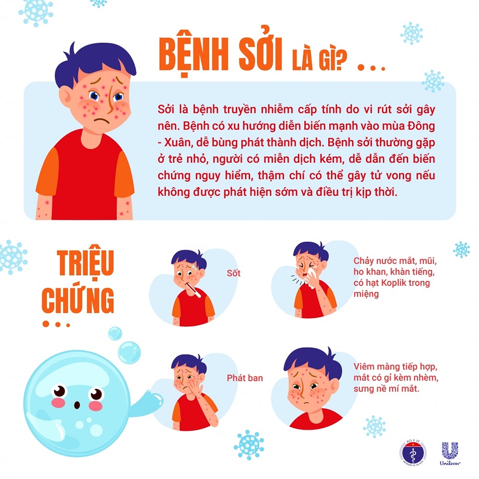 Hình ảnh minh họa sởi 1